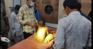 दुधावा इलाके में तेंदुए के हमले से एक मासूम बालक गंभीर रूप से हुआ घायल