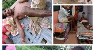 IED ब्लास्ट में 16 वर्षीय किशोरी समेत 3 ग्रामीण घायल